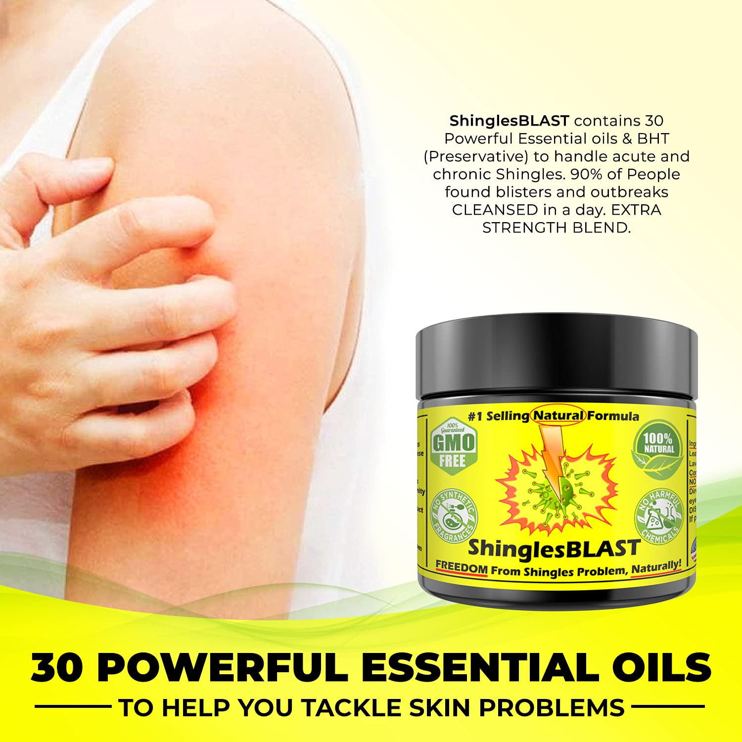 ShinglesBLAST - FAST Shingles Pain Relief Cream Powerful Natural Pure Potent Clean Ingredients - Revitalize Life Organics - 