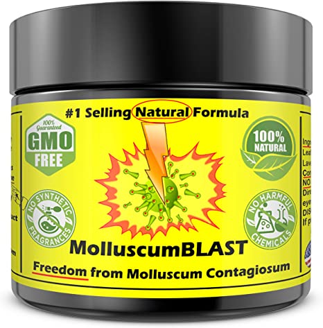 MolluscumBLAST Molluscum Contagiosum Relief Salve